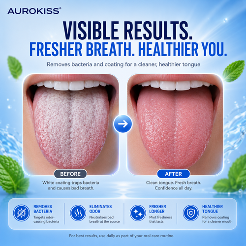 Aurokiss Tongue Gel